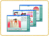 カウンセリングアニメーションソフト